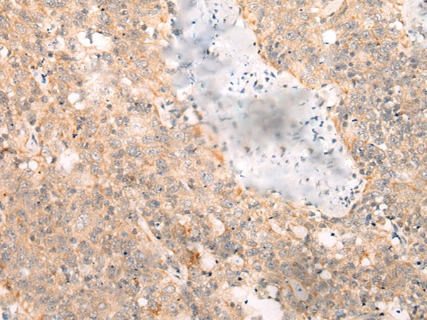 LRP8 Antibody