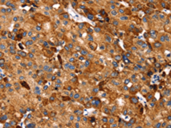 SLC27A5 Antibody