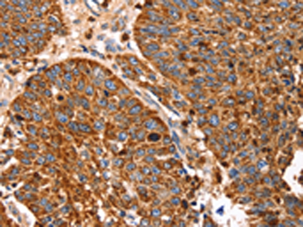 SLC27A5 Antibody