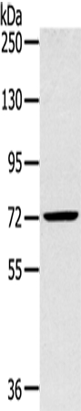 SLC27A5 Antibody