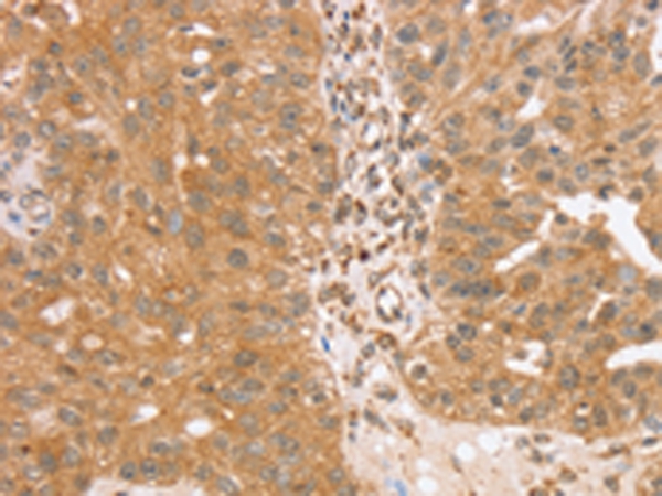 TRIM25 Antibody