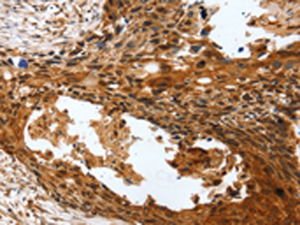 PTX3 Antibody