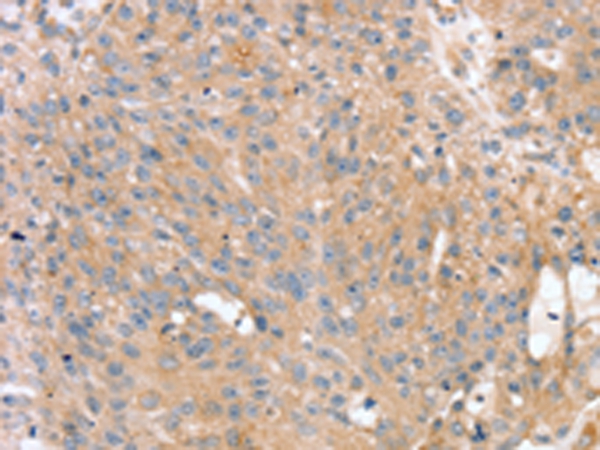 PTX3 Antibody