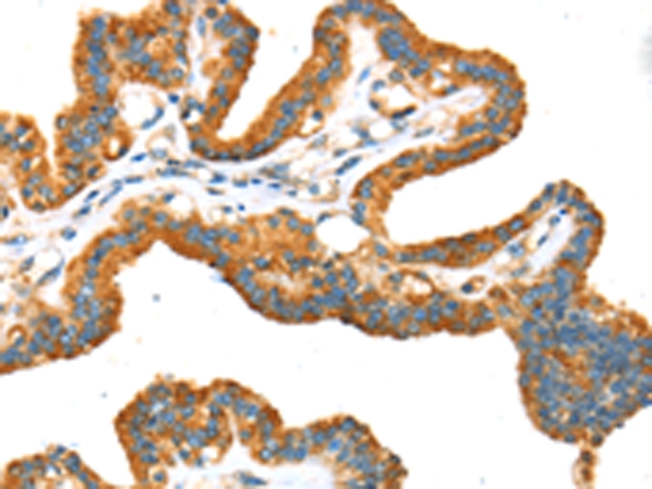 TRPV5 Antibody