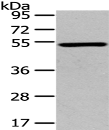 TSPYL1 Antibody