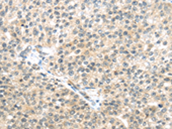 TTBK2 Antibody