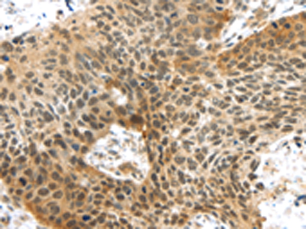 TTBK2 Antibody