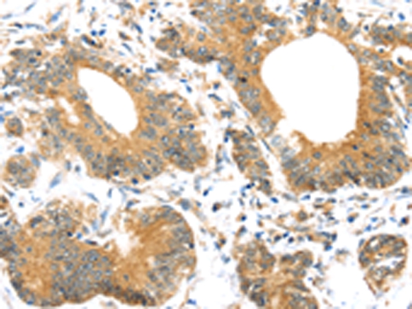 UBTD1 Antibody