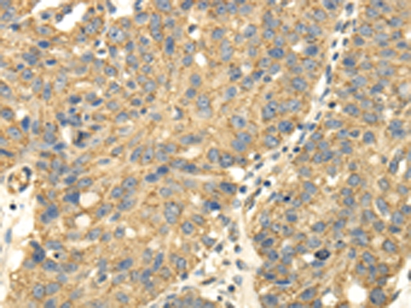 UHRF1BP1 Antibody