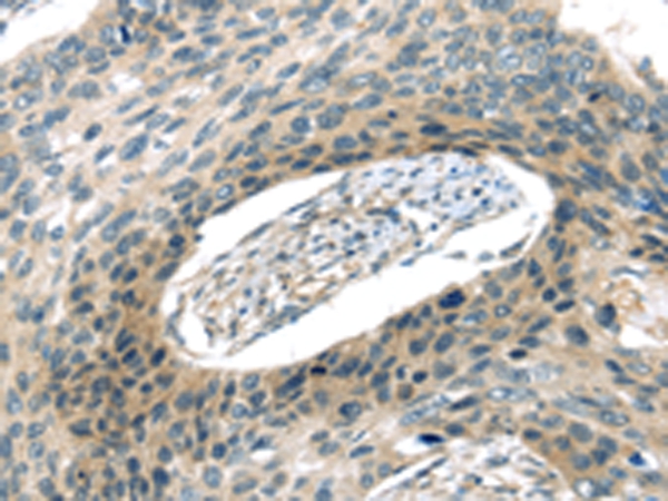 VAMP2 Antibody