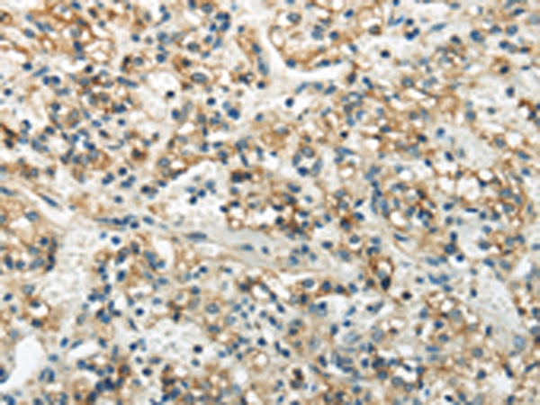 WNK3  Antibody