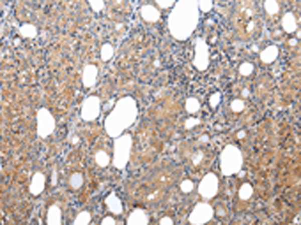 XKRX Antibody
