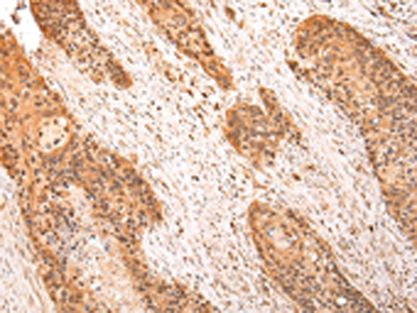 ZPR1 Antibody