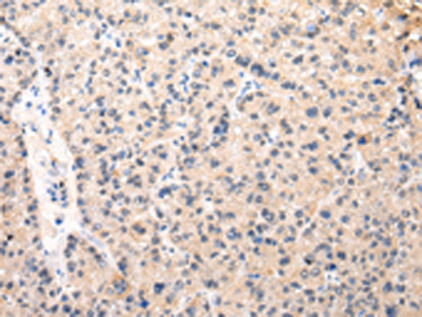 MUC1(NT) Antibody