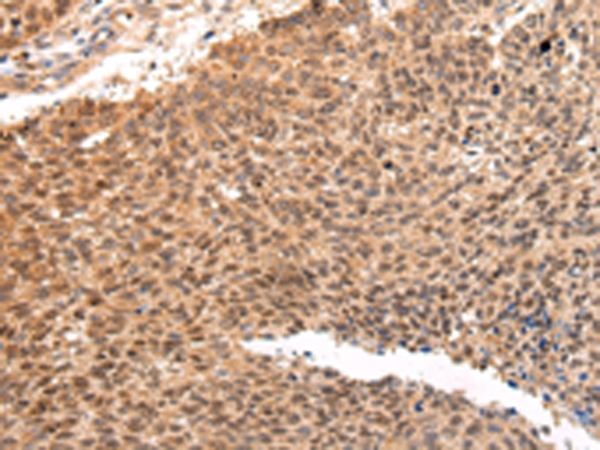 ATF1 Antibody