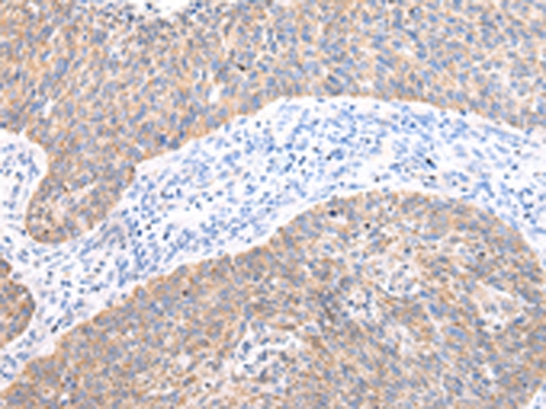 AXIN1  Antibody