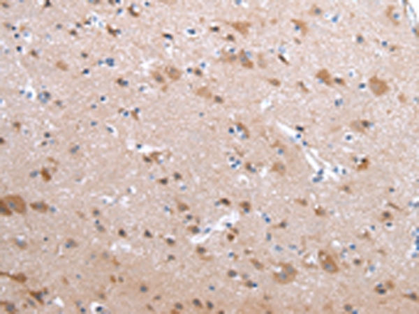 CFC1 Antibody
