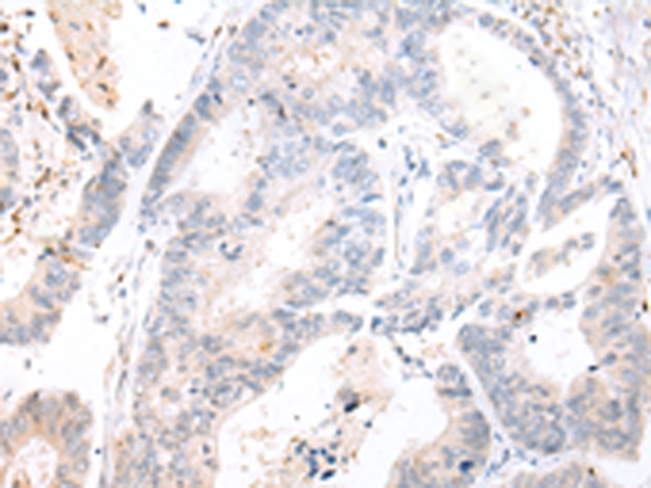 CALB2 Antibody
