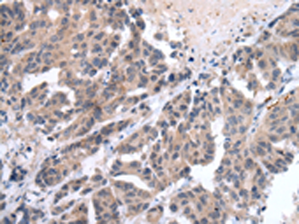 FIGF Antibody