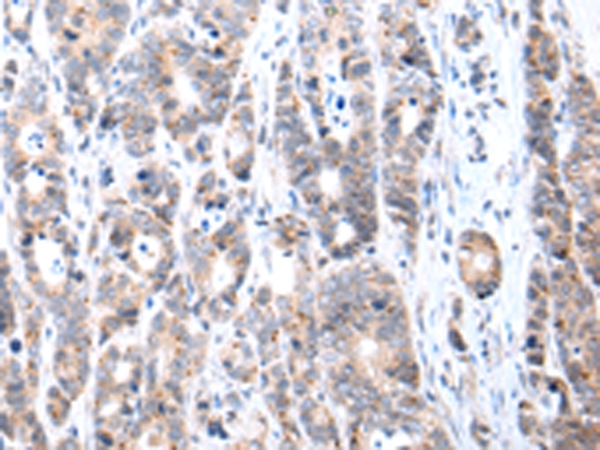 FIGF Antibody