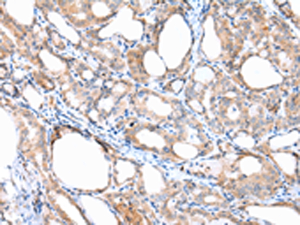 ACVRL1 Antibody