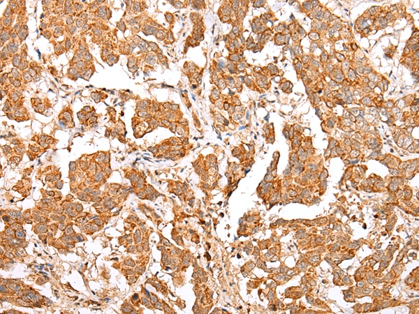 NLRP1 Antibody