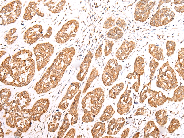 NLRP1 Antibody