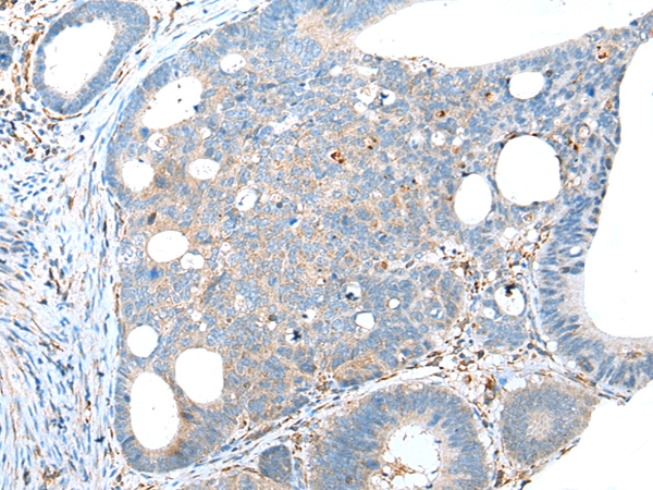 TRPV6 Antibody