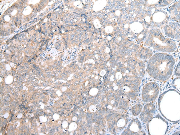 DAPK3 Antibody