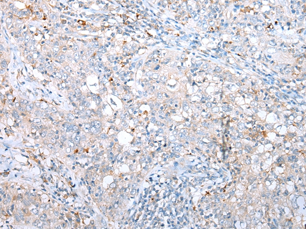 DAPK3 Antibody
