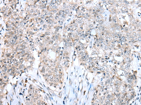 CCNT2 Antibody