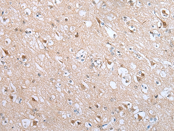 DRD3 Antibody