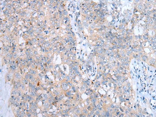 LAMP1 Antibody