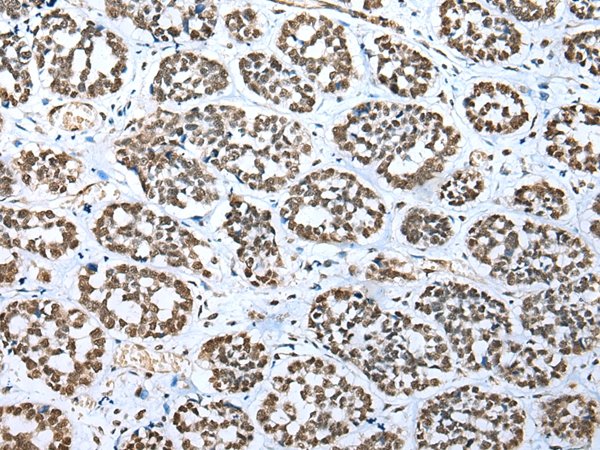 TBP Antibody