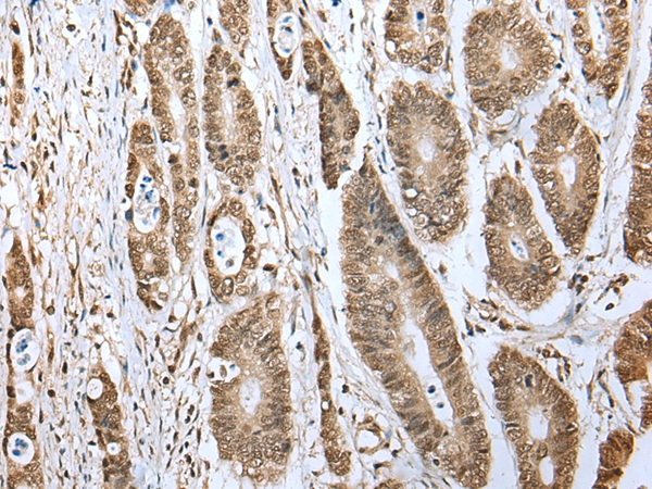TBP Antibody