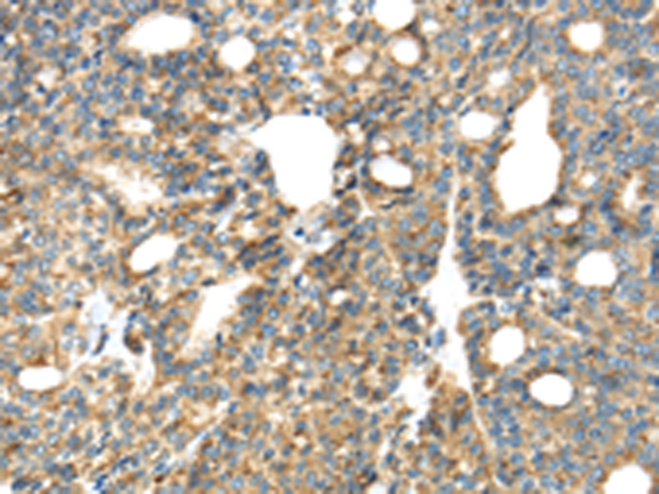 TIRAP Antibody