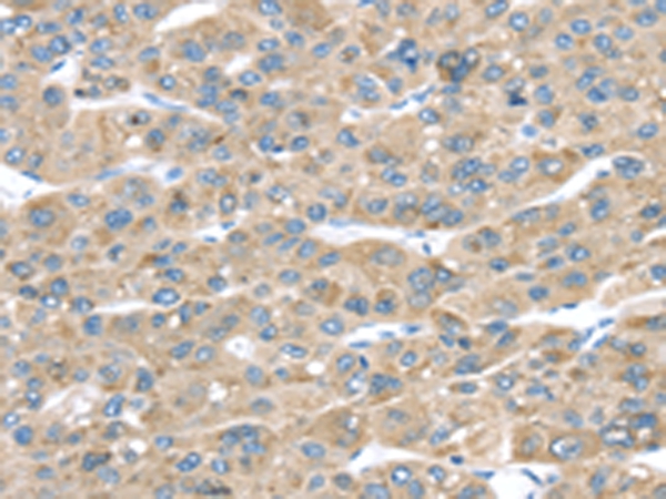 TMED2 Antibody