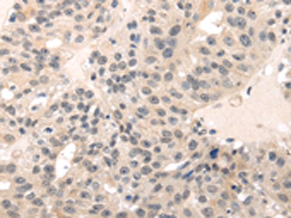 MED28 Antibody