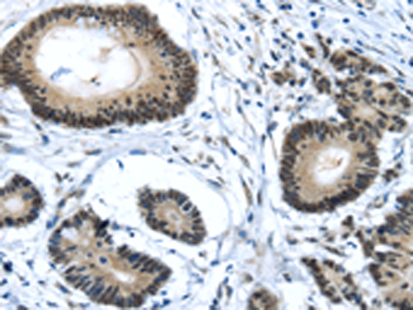 MED4 Antibody