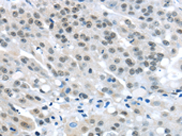 MED4 Antibody