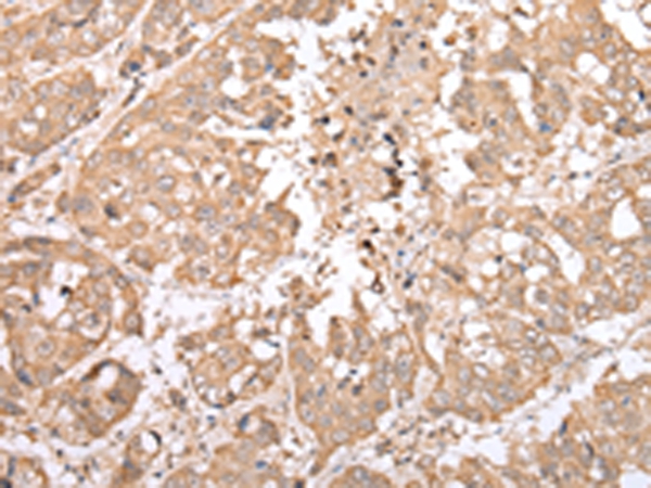 NDP Antibody