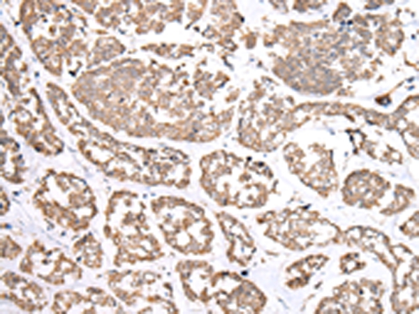 NDP Antibody