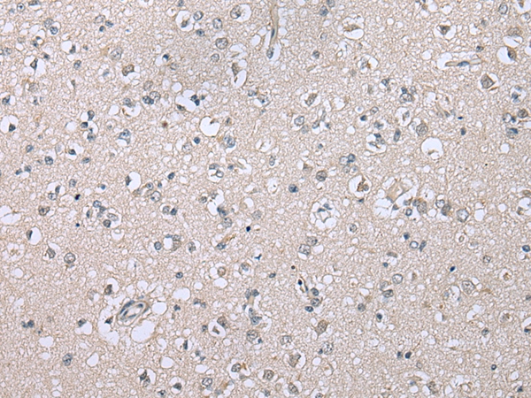 CDHR4 Antibody