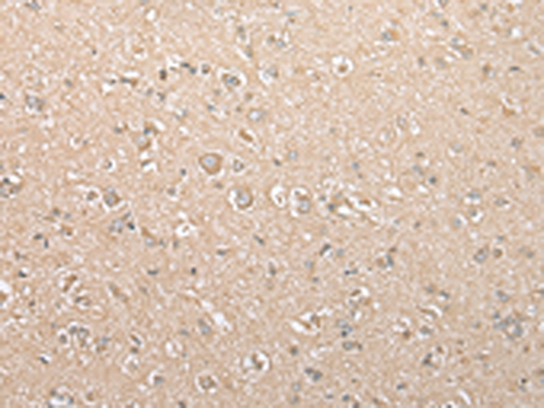 USE1 Antibody