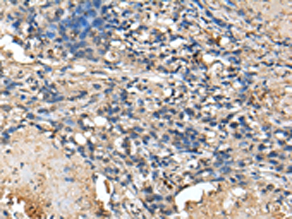 PRTFDC1 Antibody