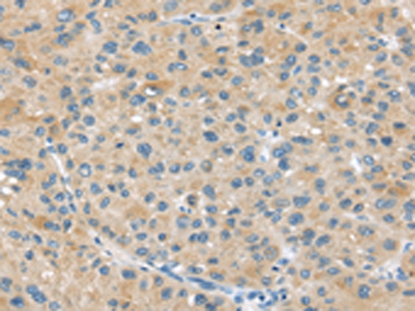 ABCC2 Antibody