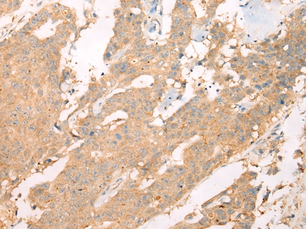 ASIC3 Antibody