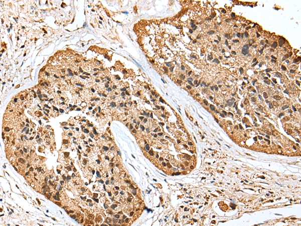 SCN1A Antibody