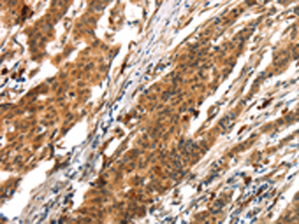 BCLAF1 Antibody
