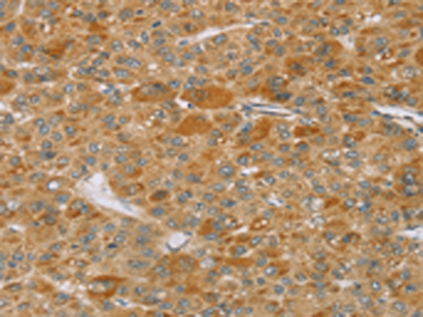 TP53I11 Antibody